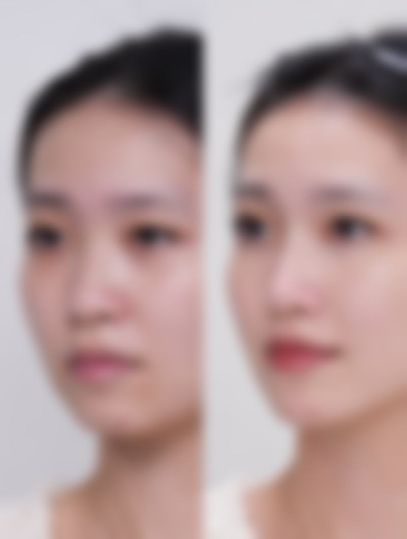 五、郑州方胜整形医疗美容诊所实例