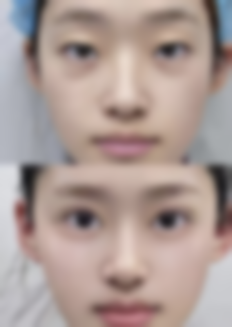 七、郑州大学第五附属医院医学整形美容真实的顾客评价如下：