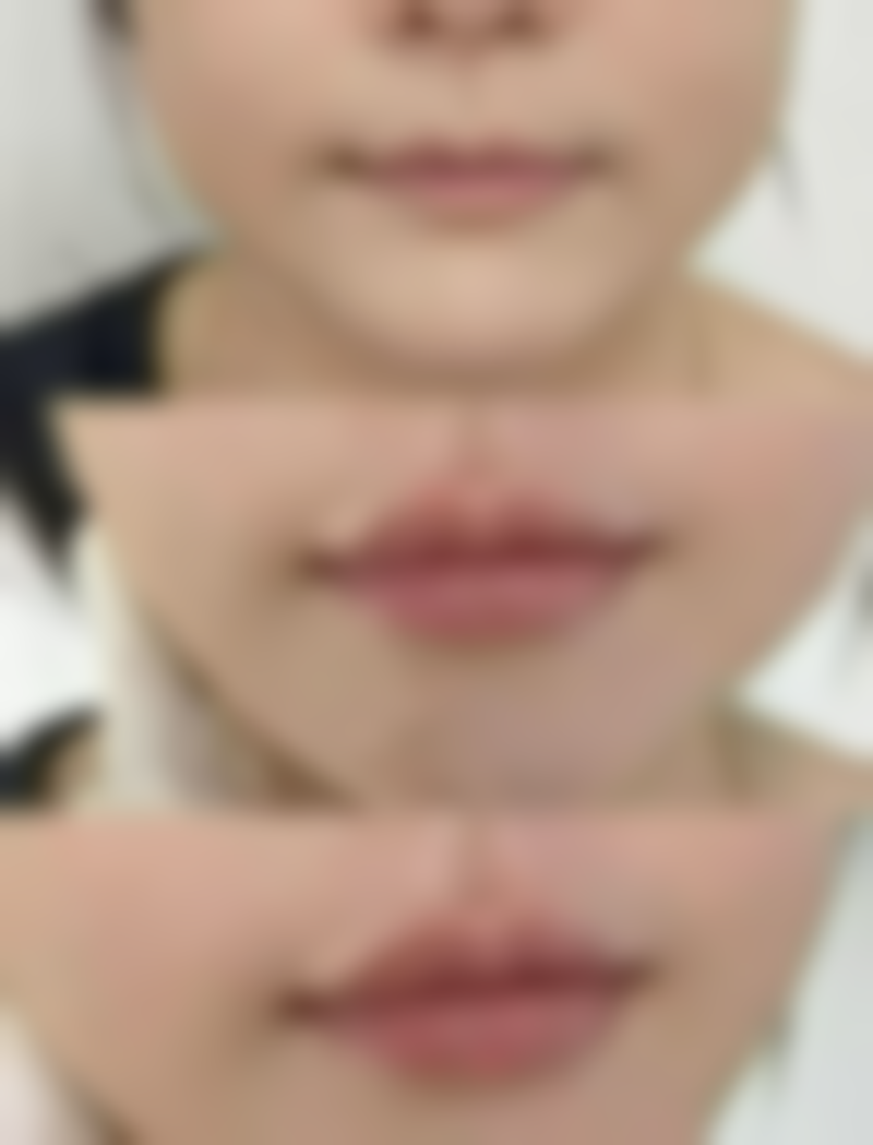 八、天津市甜橙臻美医疗美容诊所真实的顾客评价如下：