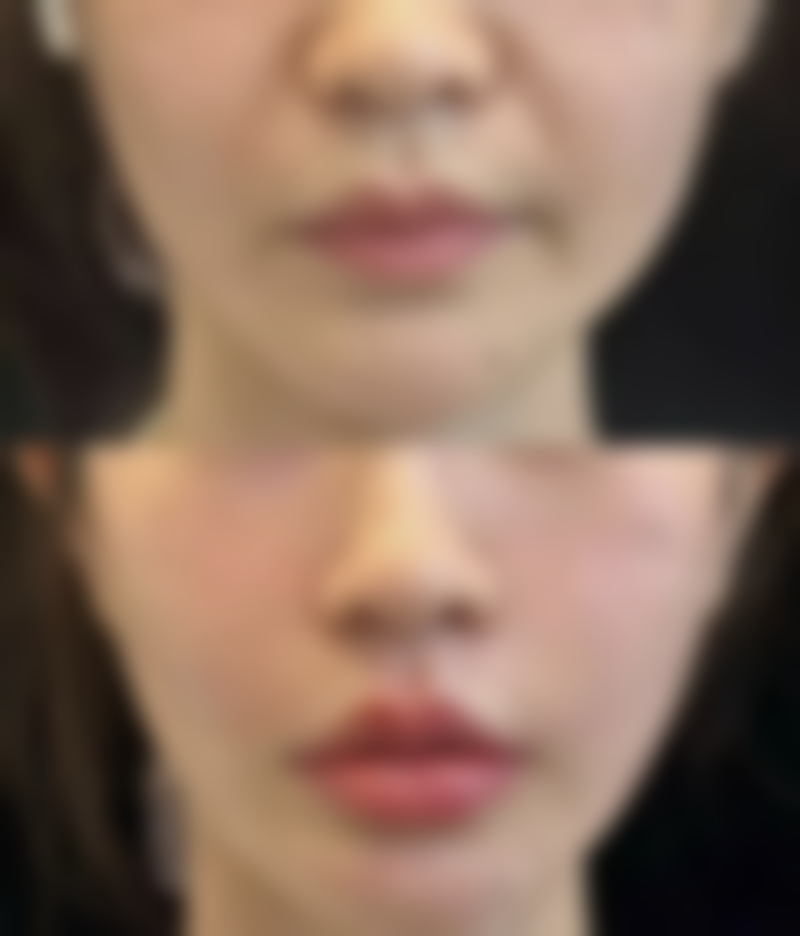 七、天津市甜橙臻美医疗美容诊所价格表：（仅供参考）