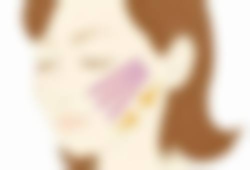 激光治疗：神奇之光，改善疤痕外观