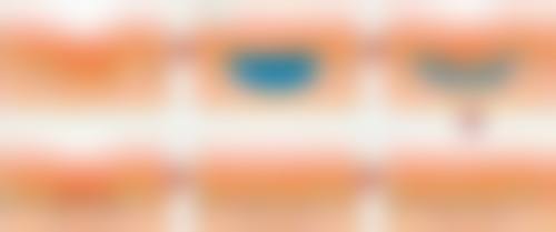 手术、激光、药物……多种治疗疤痕疙瘩的方法大揭秘，有效改善外观还降低复发风险 