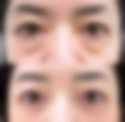 五、包头瑞薇医疗美容医院实例