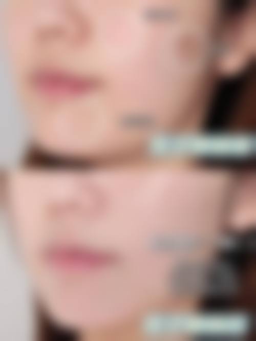 五、北京五洲妇儿整形美容医院实例