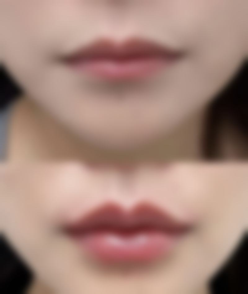 六、杭州市红十字会医院整形外科怎么预约：