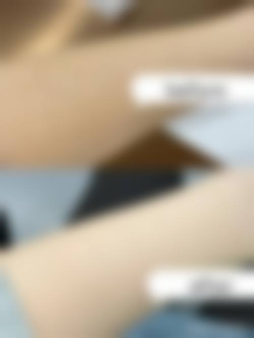 六、恩施州中 心医院烧伤整形科怎么预约：