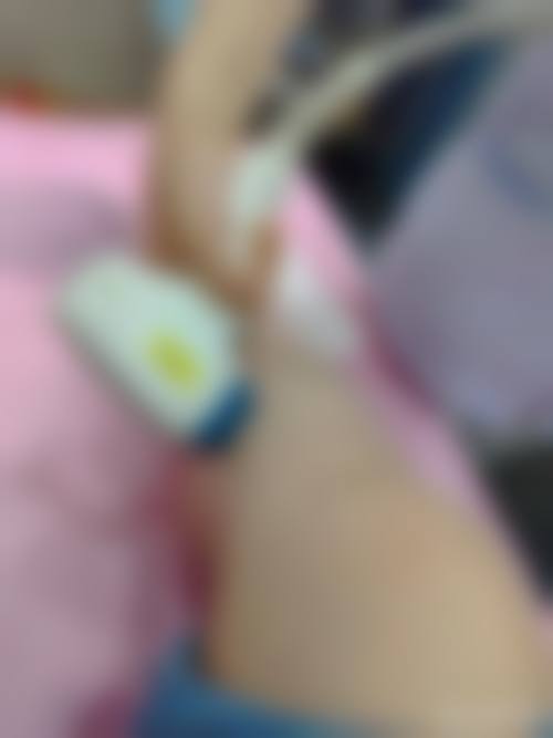 八、恩施州中 心医院烧伤整形科真实的顾客评价如下：