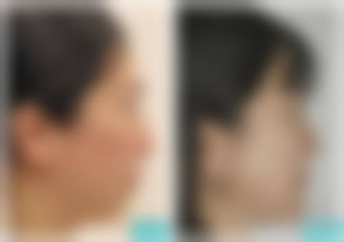 七、成都春天医疗美容门诊部价格表：（仅供参考）