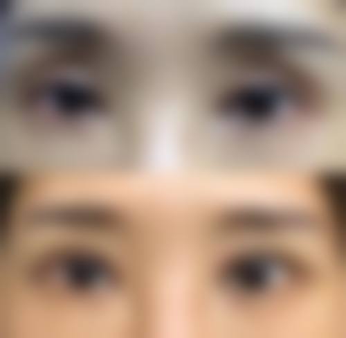 五、铜陵市人民医院（烧伤整形外科）实例