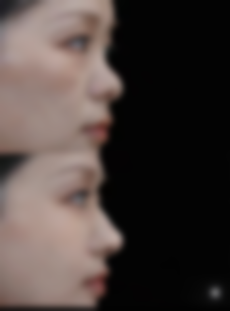 六、杭州贻美医疗美容门诊部怎么预约：