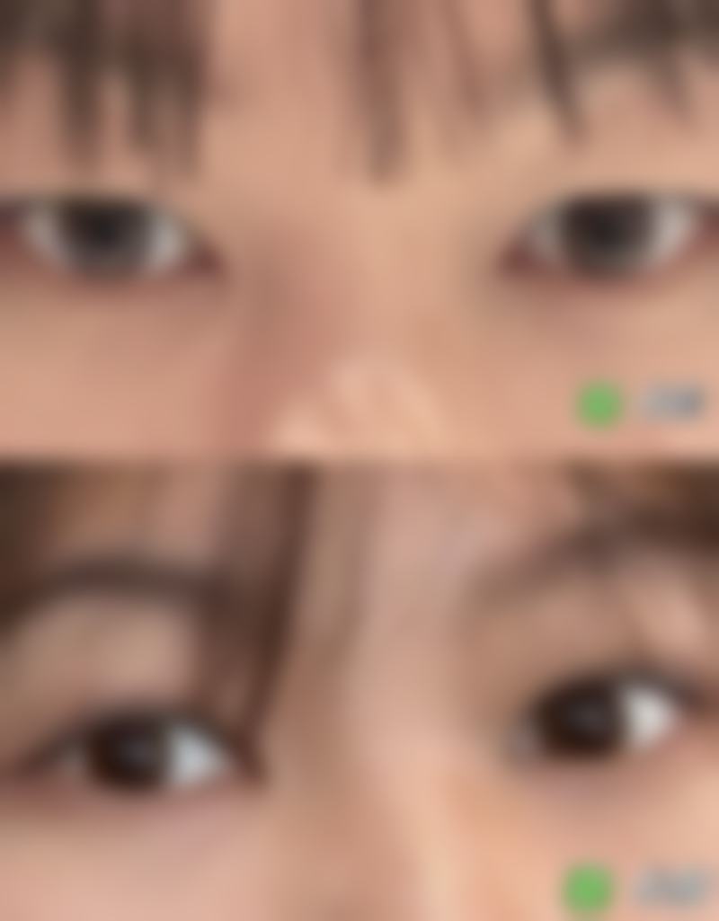 六、韩国ilove江南整形外科怎么预约：