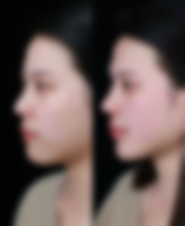 四、南通逸菲医疗美容门诊部开展的主要项目和特色项目