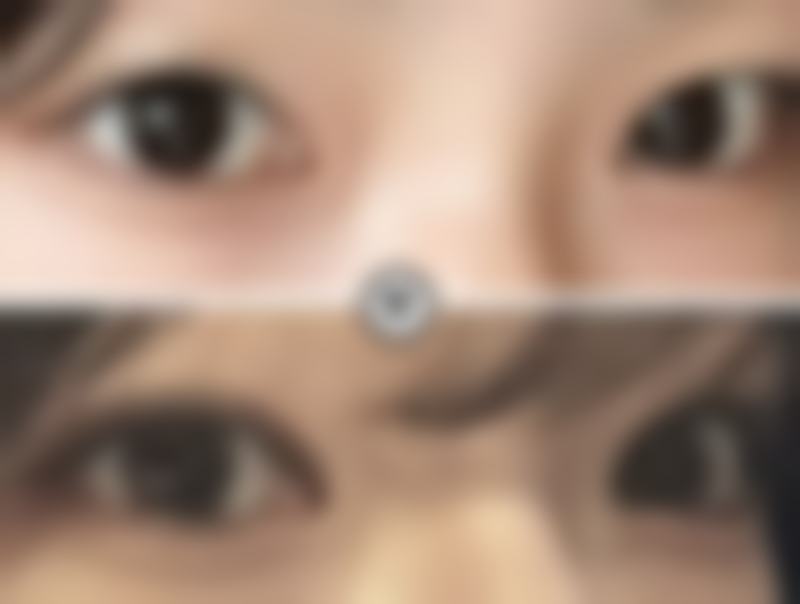 七、韩国ilove江南整形外科价格表：（仅供参考）