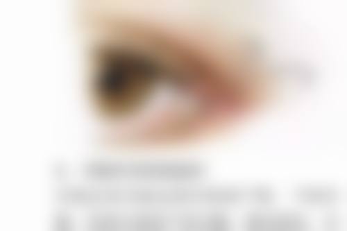 去完眼袋有皱纹别慌，肉毒素注射有良方