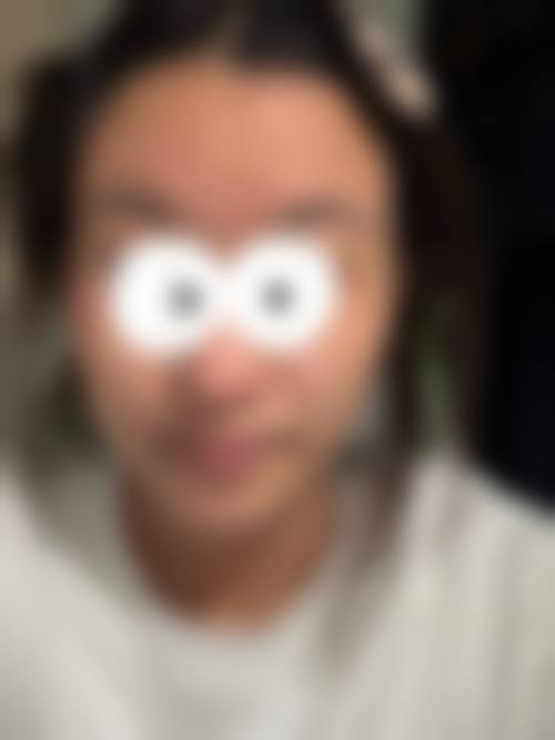 五、沈阳和平孙毓敏医疗美容诊所实例