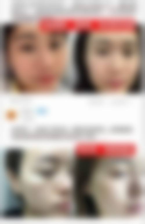 林亚红医生怎么预约?