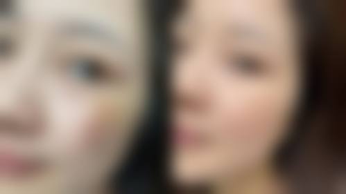 林亚红医生项目价格表参考