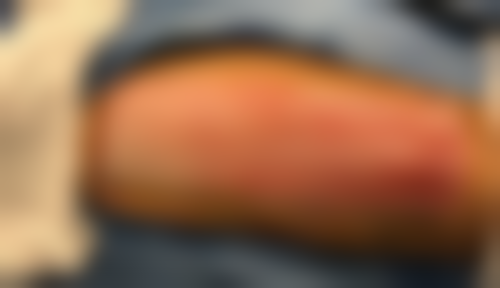 程宏宇医生眼部整形怎么样可靠吗?