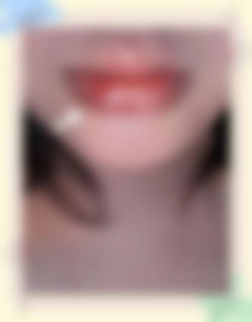 五、厦门海明医疗美容整形医院实例