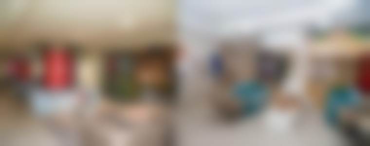 杨海皎医生激光嫩肤实例