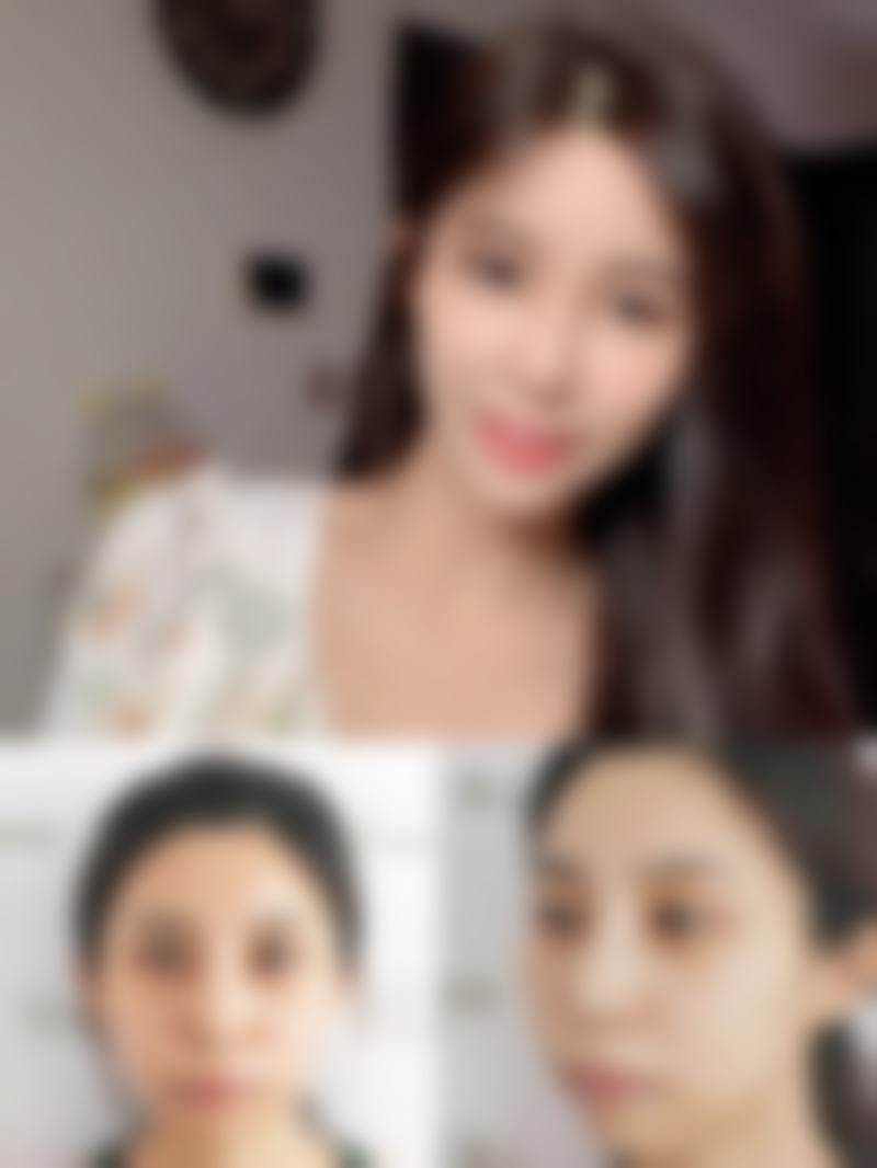 五、Ariel 大宫实例