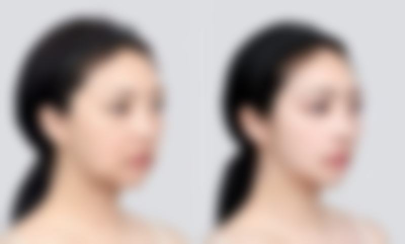 五、韩国AHN安整形医院实例