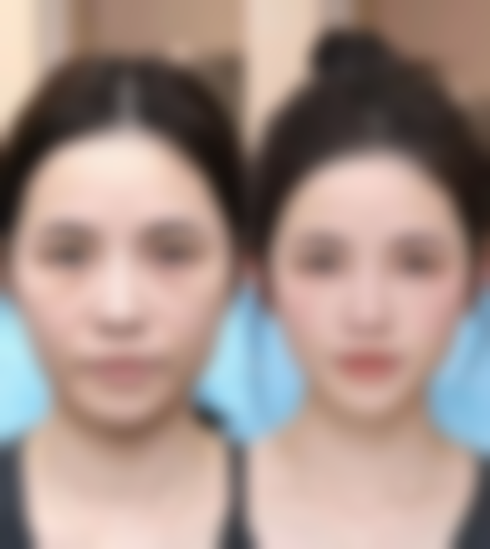 八、武汉星梦十二整形医院真实的顾客评价如下: