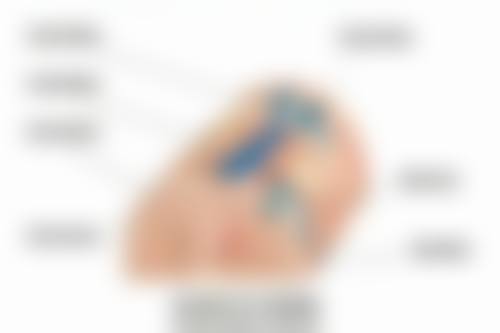 不同抽脂部位成效显现时间的差异