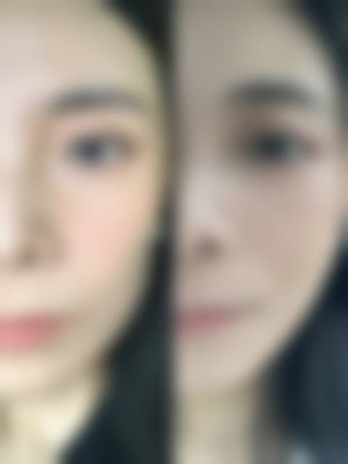 六、清潭antian抗衰医院怎么预约：