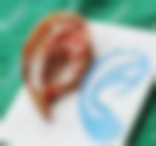 八、淮安赛尔医疗美容门诊部真实的顾客评价如下：