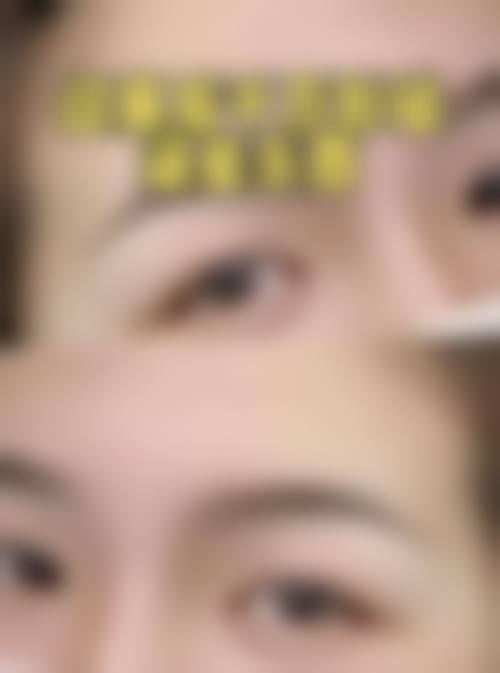 五、大庆青蓝之田整形医院实例