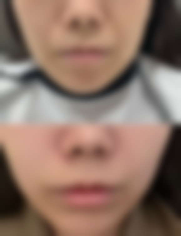 七、北京方舟医院整形美容中 心价格表：（仅供参考）