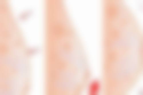 五、扬州市第一人民医院整形美容科实例