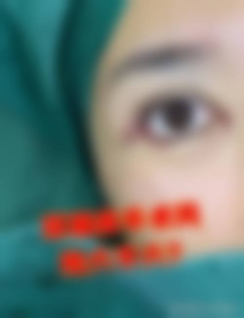 五、沈阳塑妍医疗美容门诊部实例