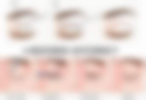 卢燕雪医生瘦脸轮廓怎么样可靠吗？