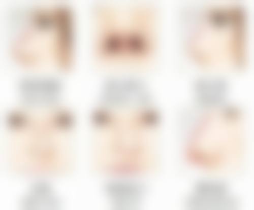 隆鼻后鼻头修复：护理要点大总结