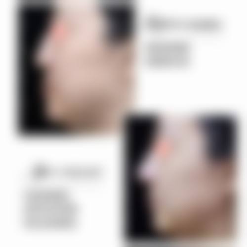 六、上海静和门诊部怎么预约：