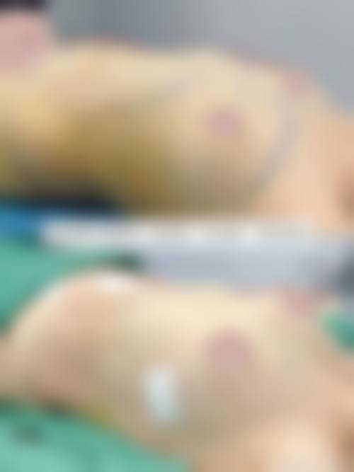 八、金华亚美整形美容医院真实的顾客评价如下：