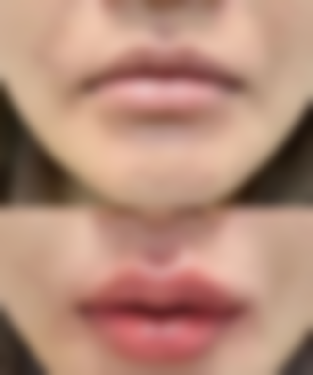 王晓伟医生项目价格表参考