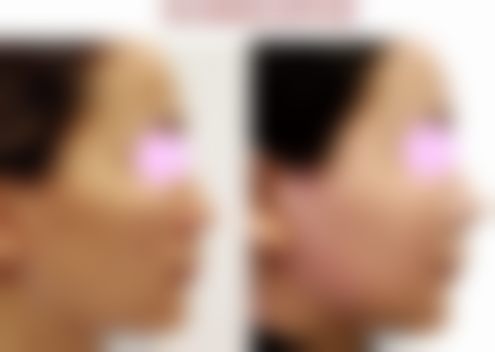 储美俊医生项目价格表参考