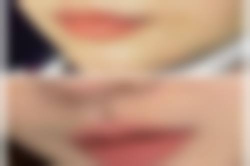 如何有效消除眼袋？术后护理不能忘