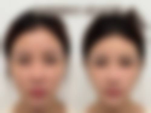 八、深圳瑞芙美臣医疗美容真实的顾客评价如下：