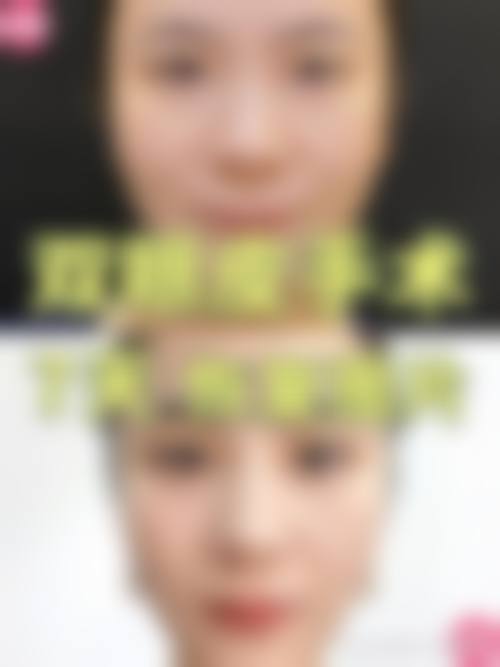 八、沈阳靓点医学美容诊所真实的顾客评价如下：