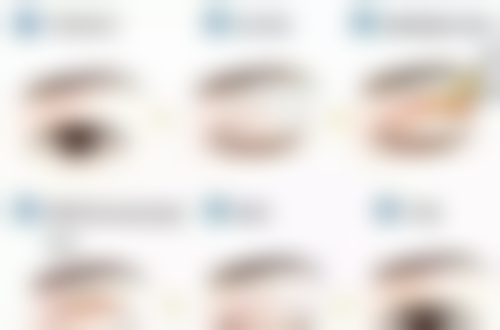 内双眼皮开眼角真实实例成效咋样?眼见为实