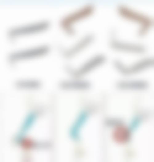 还在为双眼皮白色疤痕烦恼？激光与注射治疗显神通