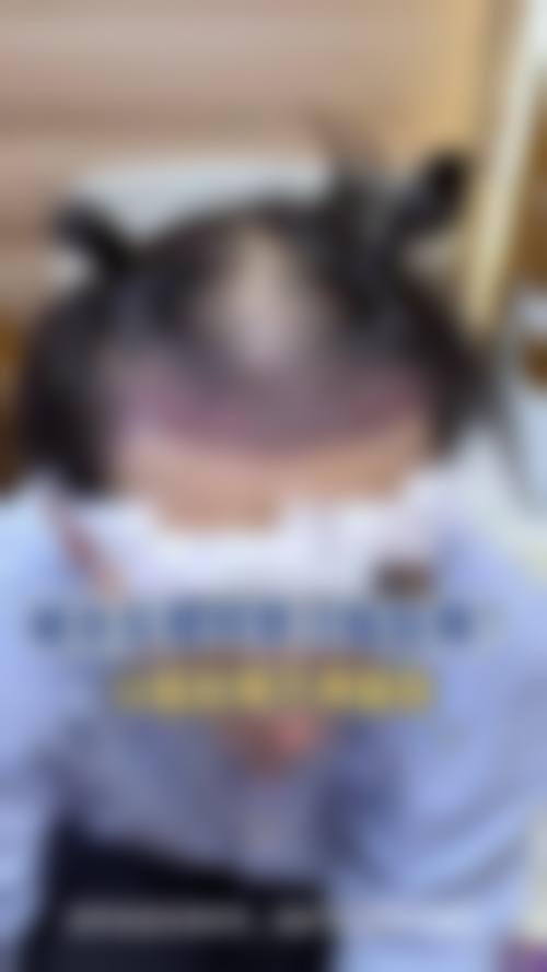 七、金华新生植发价格表：（仅供参考）