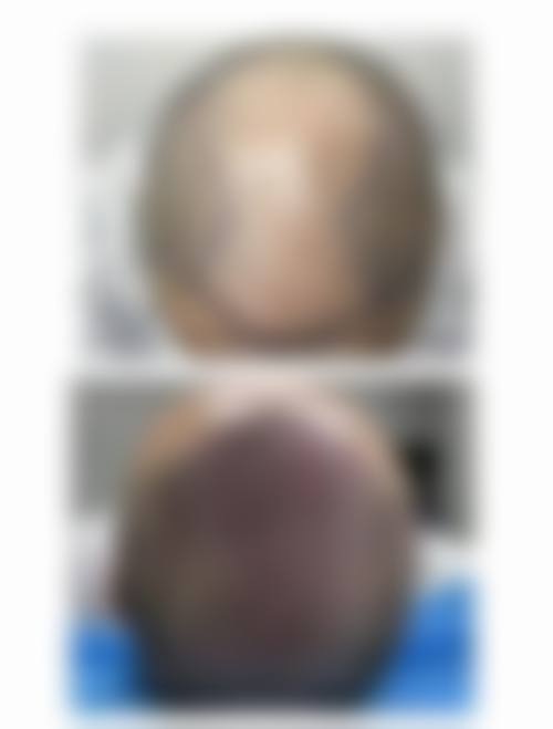 六、金华新生植发怎么预约：