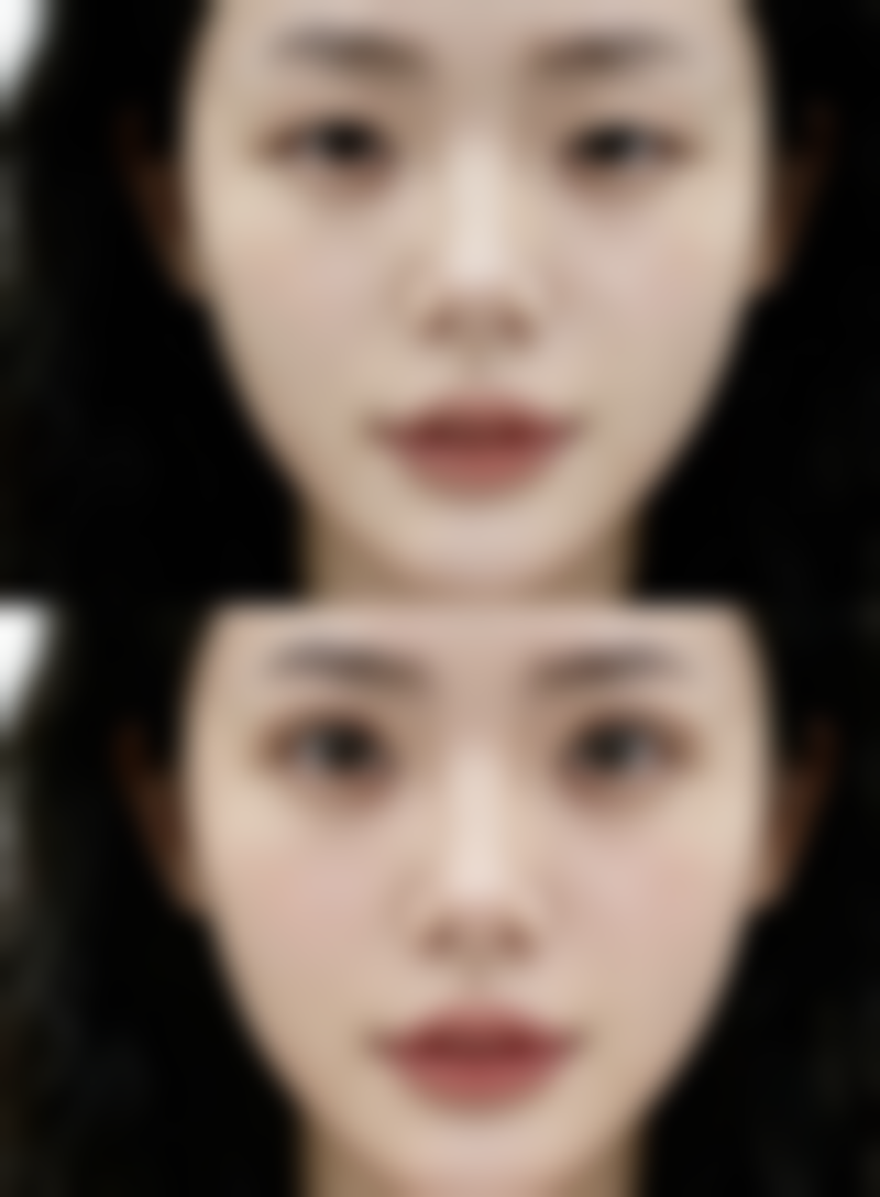 内双眼皮究竟能不能开眼角？揭秘开眼角与双眼皮搭配，让眼睛更有神采！ 