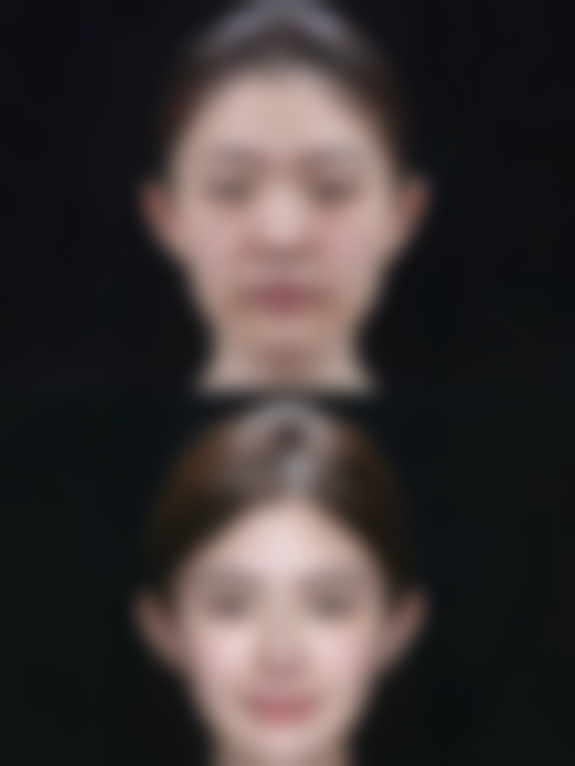 四、苏州工业园区玛汀整形医疗美容诊所实例