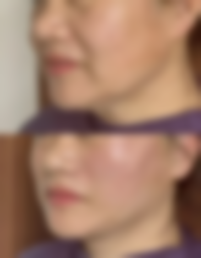 五、首尔丽格皮肤科实例